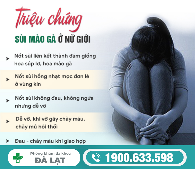 Hình ảnh minh họa